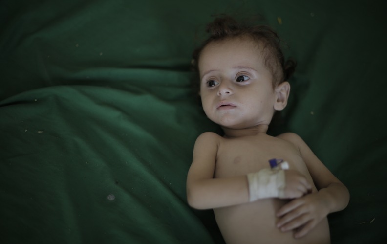 Aufgrund des Bürgerkrieges im Jemen leiden 400.000 Kleinkinder an schwerer Mangelernährung. Sieben Millionen Kinder hungern.  © UNICEF Deutschland