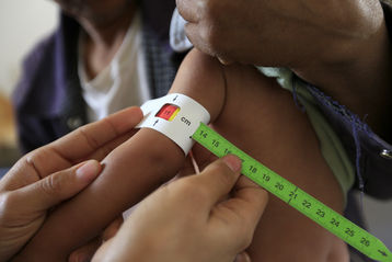 Das Maßband zeigt an, ob Kinder das für ihr Alter entsprechende Körpergewicht besitzen. Rote Zahlen deuten auf schwere Mangelernährung hin. © UNICEF Deutschland Das Maßband zeigt an, ob Kinder das für ihr Alter entsprechende Körpergewicht besitzen. Rote Zahlen deuten auf schwere Mangelernährung hin. © UNICEF Deutschland