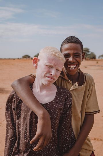 Junge mit Albinismus und Freund